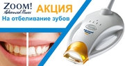 Отбеливание Зубов Аппаратом 